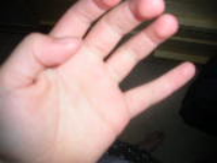 thumb